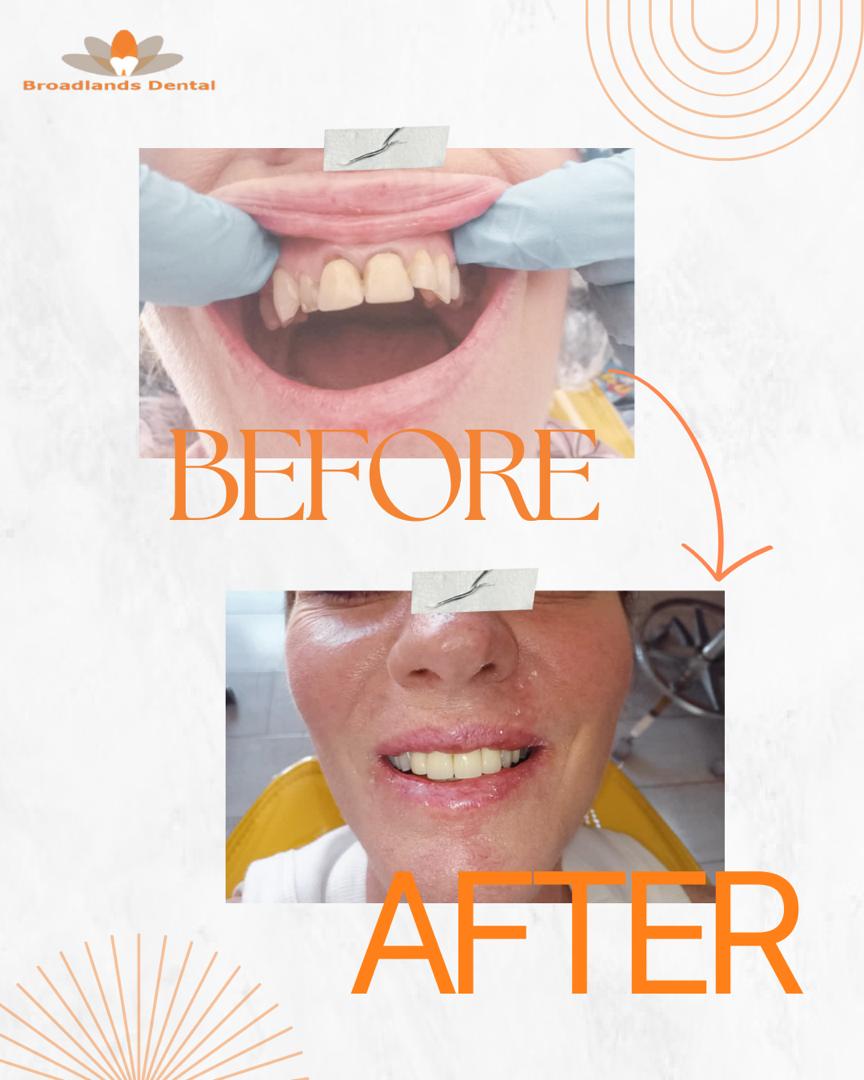 Restorative Dentistry